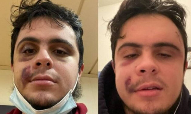 Xανιά - Νέα καταγγελία για οπαδική βία: Χτύπησαν άγρια 23χρονο στη μέση του δρόμου