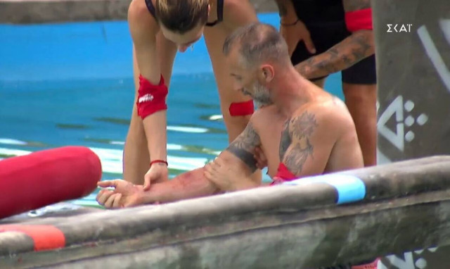 Survivor: Σοβαρός τραυματισμός για παίκτη των Διάσημων