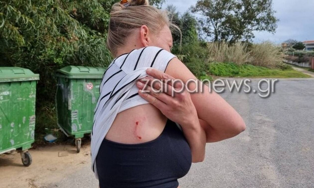 Κρήτη: Σκύλος επιτέθηκε και τραυμάτισε γυναίκα – Μεταφέρθηκε σε νοσοκομείο