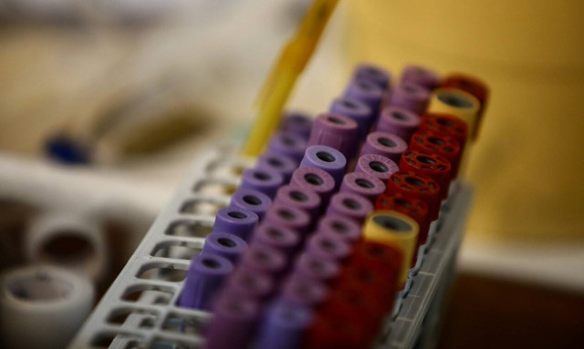 ΕΚΠΑ: COVID-19 και αιμοδοσία - Τι ισχύει στην Ελλάδα