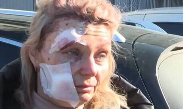 Πόλεμος στην Ουκρανία: Η δασκάλα - σύμβολο που συγκίνησε όλο τον πλανήτη