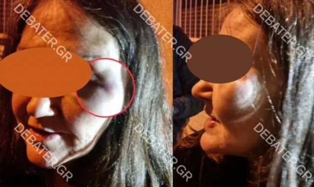 Τρόμος για γυναίκα στον Άγιο Παντελεήμονα: Πώς σώθηκε από την επιμονή των αστυνομικών