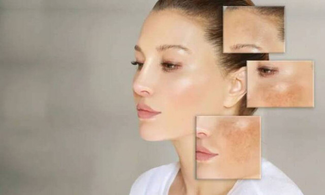 Πείτε αντίο στις δυσχρωμίες