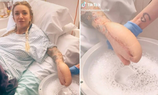 Βρετανία: Πήγε με πέτρα στα νεφρά και κατέληξε με χέρι... καρχαρία - Η απίστευτη περιπέτεια νεαρής