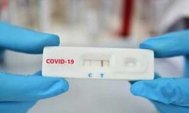 Κορονοϊός: Ποιοι μη εμβολιασμένοι εργαζόμενοι δεν κάνουν από σήμερα (5/4) rapid test