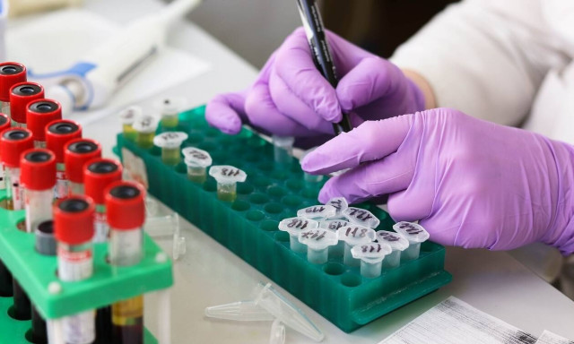 Νέο τεστ αίματος προβλέπει τον κίνδυνο εμφράγματος και εγκεφαλικού με αυξημένη ακρίβεια