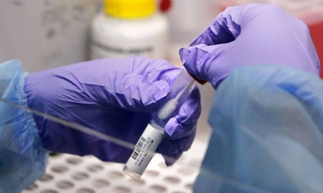 Greece: 9,308 new coronavirus infections, 57 deaths on Thursday; 334 on ventilators