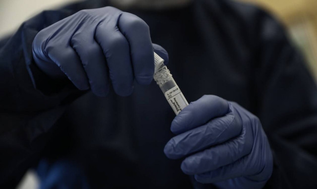 Πάτρα: Η έρευνα για το θάνατο της Μαλένας ξεκινά από μηδενική βάση - Τα αναπάντητα ερωτήματα