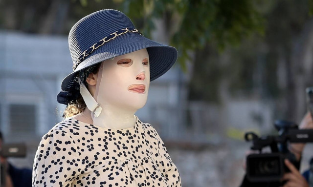 Ιωάννα Παλιοσπύρου: «Το έγκαυμά της ίσως είναι το μεγαλύτερο παγκοσμίως», λέει η γιατρός της