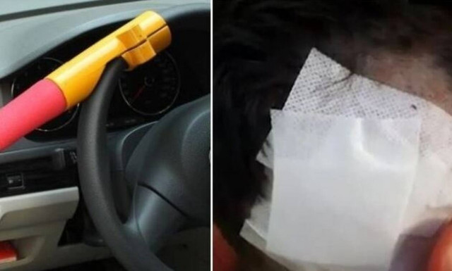 Άγριο το χτύπημα στον 20χρονο στη Ν. Φιλαδέλφεια: «Το κόκαλο του κεφαλιού μπήκε μέσα 2,5 εκ.»