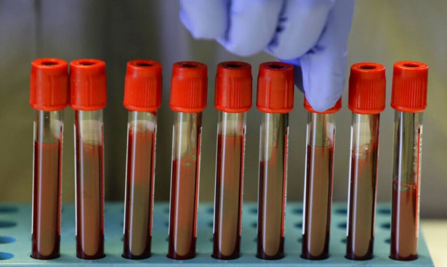 Τριήμερο «λουκέτο» σε διαγνωστικά κέντρα και εργαστήρια στις 26, 27 και 28 Μαΐου