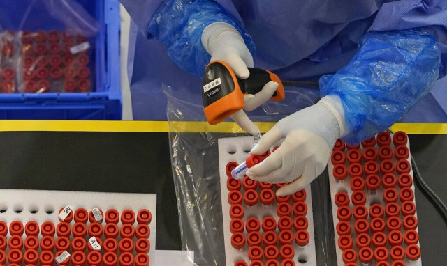 Ευλογιά των πιθήκων και ανεμοβλογιά: Ο ΕΟΔΥ εξηγεί γιατί διαφέρουν