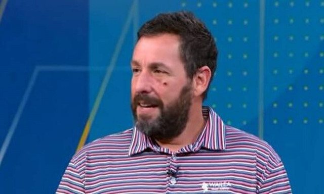 Άνταμ Σάντλερ: Το «ατύχημα στο κρεβάτι» και το μαυρισμένο μάτι (vid)