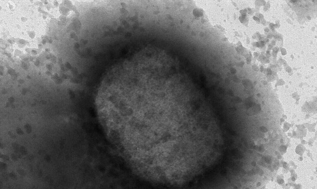 Ευλογιά των πιθήκων - CDC: Τα κρούσματα ξεπέρασαν τα 1.000 παγκοσμίως  - Εντοπίζονται σε 29 χώρες