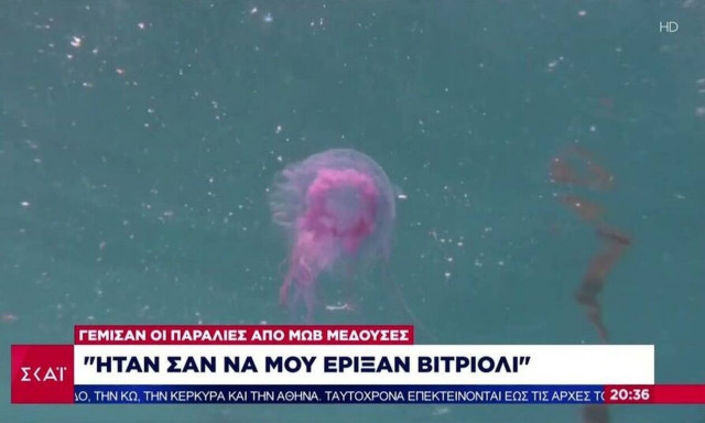 Μαρτυρία γυναίκας για τη μωβ μέδουσα: «Δεν μπορείς να περιγράψεις τον πόνο, το κάψιμο που έχεις»