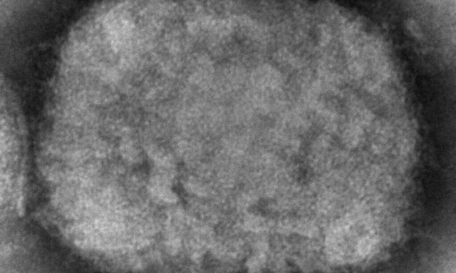 Βραζιλία: Δεύτερο επιβεβαιωμένο κρούσμα της ευλογιάς των πιθήκων στη χώρα