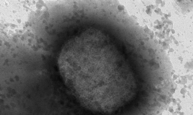 Ευλογιά των πιθήκων - ΠΟΥ: Στο επίκεντρο η Ευρώπη - Παρουσία του ιού στο σπέρμα ασθενών