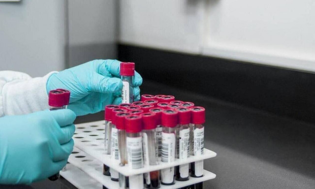 Μαγιορκίνης για μεταπνευμονοϊό: «Τον ξέρουμε από το 2001, η γρίπη είναι πιο σοβαρή»