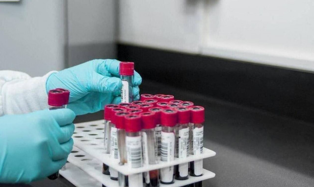 Ευλογιά των πιθήκων: Δύο τα επιβεβαιωμένα κρούσματα στην Ελλάδα - Η ανακοίνωση του ΕΟΔΥ