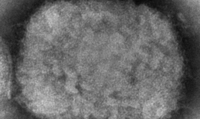 ΠΟΥ: Αποφασίζει αν θα κηρύξει υγειονομική κατάσταση έκτακτης ανάγκης για την ευλογιά των πιθήκων