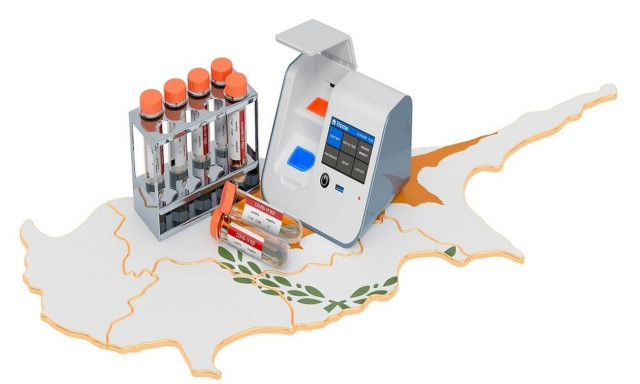 Κορονοϊός στην Κύπρο: Εκτόξευση κρουσμάτων - Στο 9,7% το ποσοστό θετικότητας