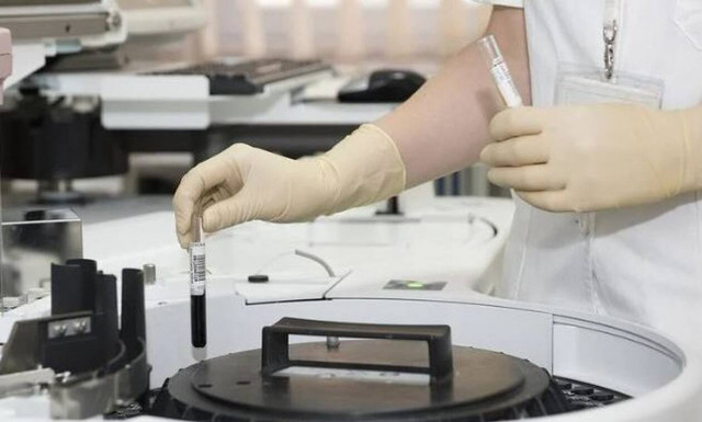 Ευλογιά των πιθήκων: Συνολικά 7 τα περιστατικά στη χώρα μας