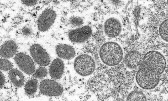 Ευλογιά των πιθήκων: Επείγουσα δράση στην Ευρώπη ζητεί ο ΠΟΥ - Ραγδαία αύξηση κρουσμάτων