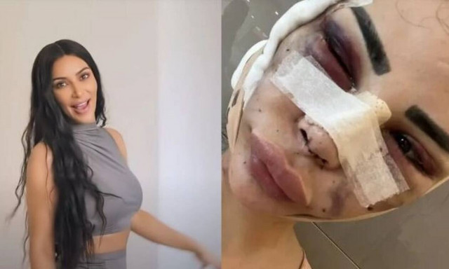 Πρώην μοντέλο του Versace ξόδεψε $600.000 για να γίνει Kim Kardashian και τώρα θέλει να επανέλθει