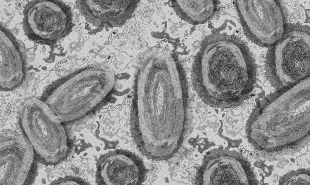 ΠΟΥ: Περισσότερα από 18.000 κρούσματα της ευλογιάς των πιθήκων παγκοσμίως