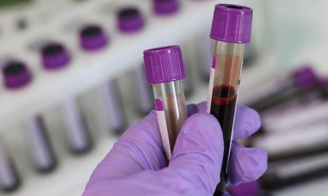 Βρετανία: Αποζημιώσεις 100.000 στερλινών στα θύματα για το σκάνδαλο με το μολυσμένο αίμα