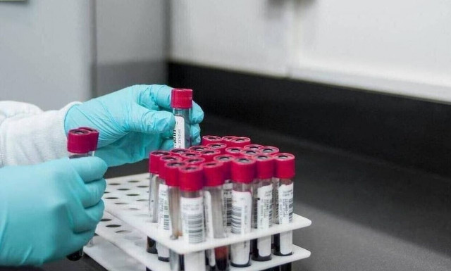 Ευλογιά των πιθήκων: Τι έδειξε μελέτη από το Λονδίνο για μετάδοση και συμπτώματα