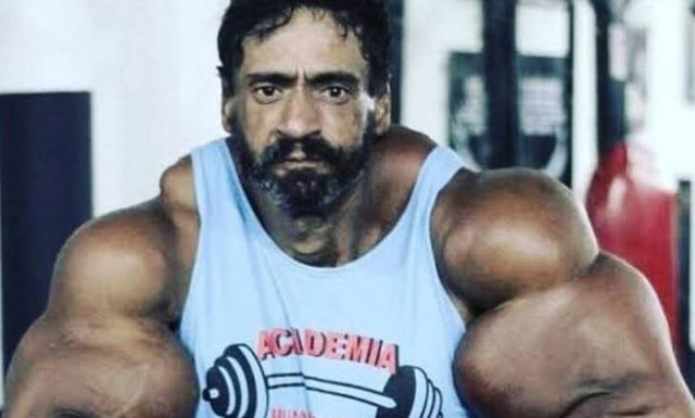 Πέθανε ο «Βραζιλιάνος Hulk» που έκανε ενέσεις λαδιού για να δημιουργήσει εξωπραγματικά μπράτσα