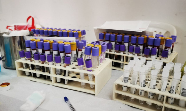 Ελλείψεις αίματος σε όλη τη χώρα - Αναβάλλονται προγραμματισμένες μεταγγίσεις