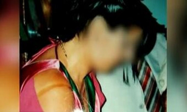 Μεσσήνη: Τα πρώτα λόγια της 49χρονης μετά την επίθεση με καυστικό υγρό - «Θα τα καταφέρω» (vid)