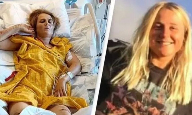 Καλιφόρνια: Ορειβάτης που έσπασε σχεδόν κάθε κόκαλό της, χρωστάει 1,2 εκατ. δολάρια σε νοσοκομεία