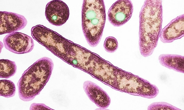 Αργεντινή: Σε βακτήριο λεγιονέλλας οφείλεται η πνευμονία από την οποία πέθαναν τέσσερις άνθρωποι    