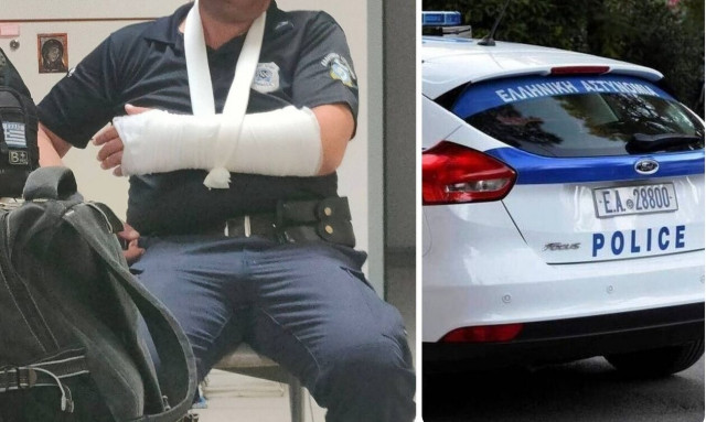 Λάρισα: Συγκλονίζουν οι εικόνες με τους τραυματισμένους αστυνομικούς από επίθεση 30 ατόμων (pics)