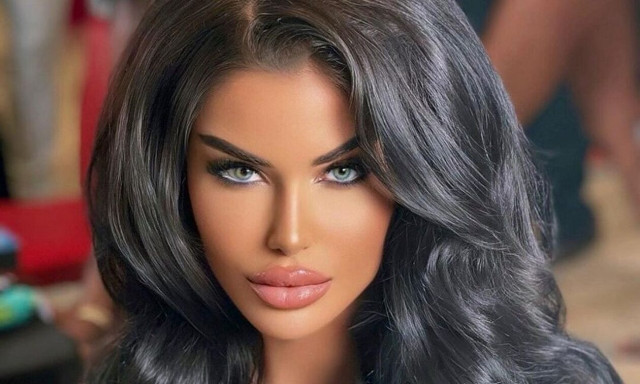 Ιωάννα Μπέλλα για τις πλαστικές: «Θα κάνω ό,τι θέλω και δεν θα δώσω λογαριασμό σε κανέναν»