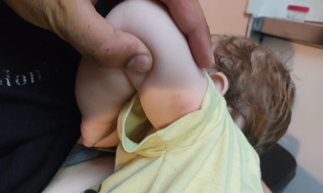 Δάγκωμα βρέφους από λυκόσκυλο: Συγκλονίζει η περιγραφή του πατέρα - «Δάγκωνε με μανία το παιδί μου»