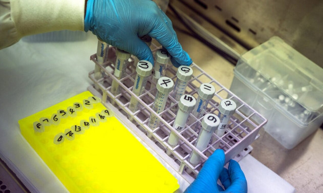 Ιδρύεται το πρώτο Ελληνικό Ινστιτούτο Γονιδιωματικής του Ανθρώπου