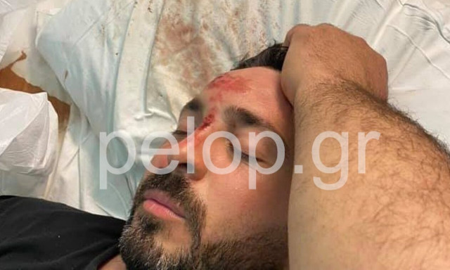 Πάτρα: Έβαλε όπισθεν και τον πάτησε με το αυτοκίνητο - Κατηγορείται για απόπειρα ανθρωποκτονίας