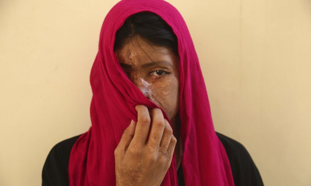 Γυναίκες που υπέστησαν επίθεση με οξύ χρησιμοποιεί ως μοντέλα Ιρανή σχεδιάστρια