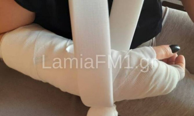 Λαμία: Συγκλονίζει η 35χρονη που δέχτηκε την επίθεση σκύλου (pics - vid)