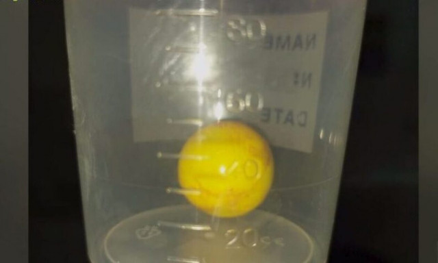 Αμαλιάδα: Καρδιοχτύπι για μωρό οκτώ μηνών που κατάπιε μπαλάκι - «Σώθηκε για λίγα δευτερόλεπτα»