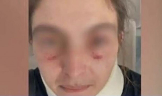 Είχε χτυπήσει ξανά την πρώην σύζυγό του ο άνδρας που κατηγορείται ότι την απήγαγε και τη βίασε