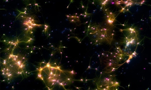 Επιστήμονες δίδαξαν σε εγκεφαλικά κύτταρα να παίζουν «τένις»