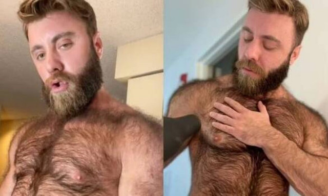 Πραγματικός «λυκάνθρωπος» στην Καλιφόρνια