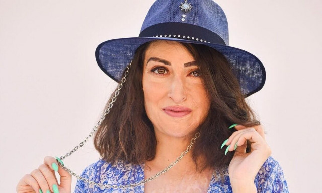 Ιωάννα Παλιοσπύρου: Παίρνει θέση για τη νέα επίθεση με καυστικό υγρό