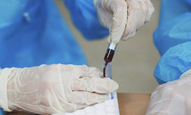 Στην άυλη συνταγογράφηση οι εξετάσεις για τον καρκίνο του μαστού