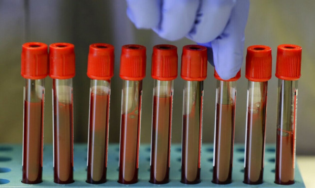 Ξεκίνησε η συνταγογράφηση γονιδιακών εξετάσεων για τον καρκίνο